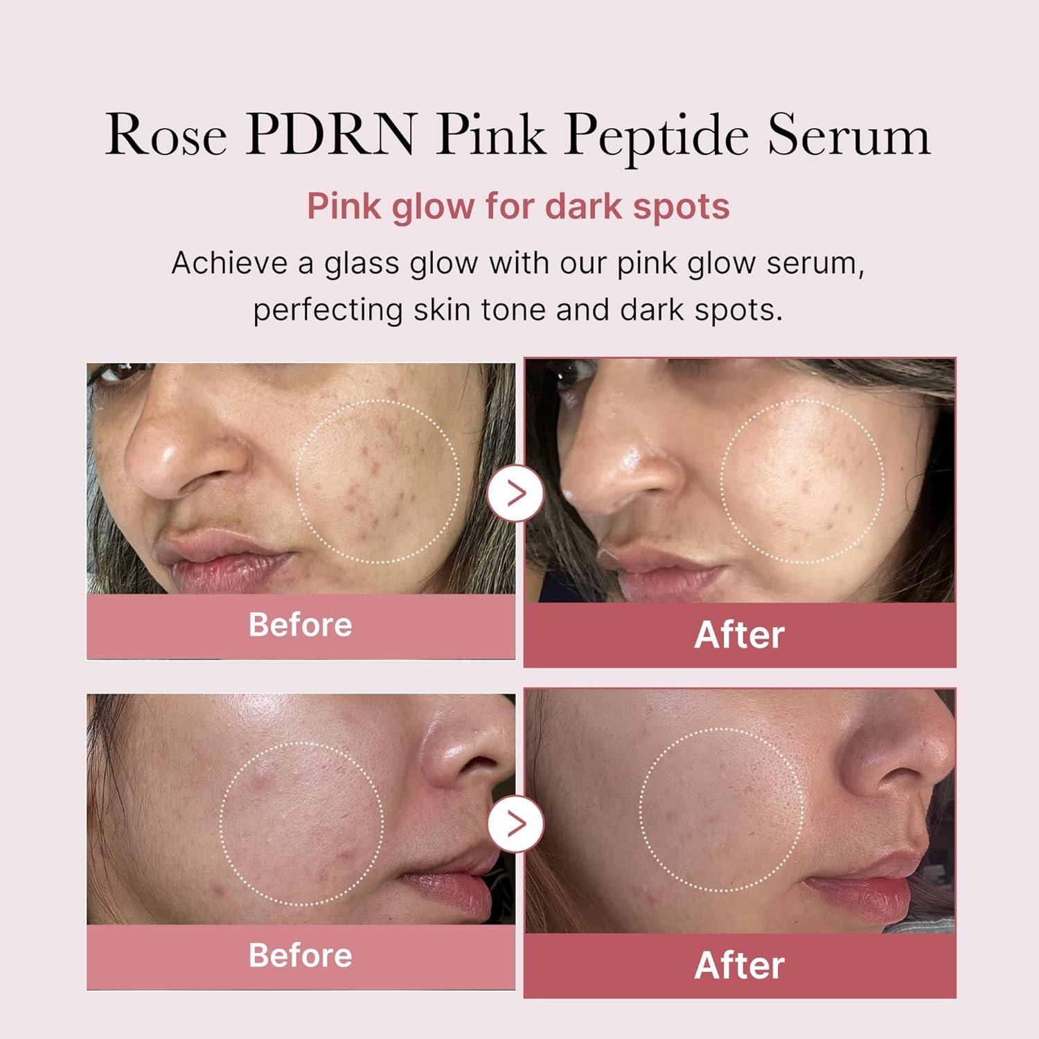 Medicube - PDRN Pink Peptide Serum 30 ml - Image 2
