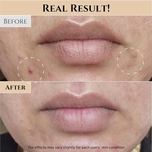 Beauty of Joseon Glow Serum Propolis + Niacinamide 30Ml - Image 6