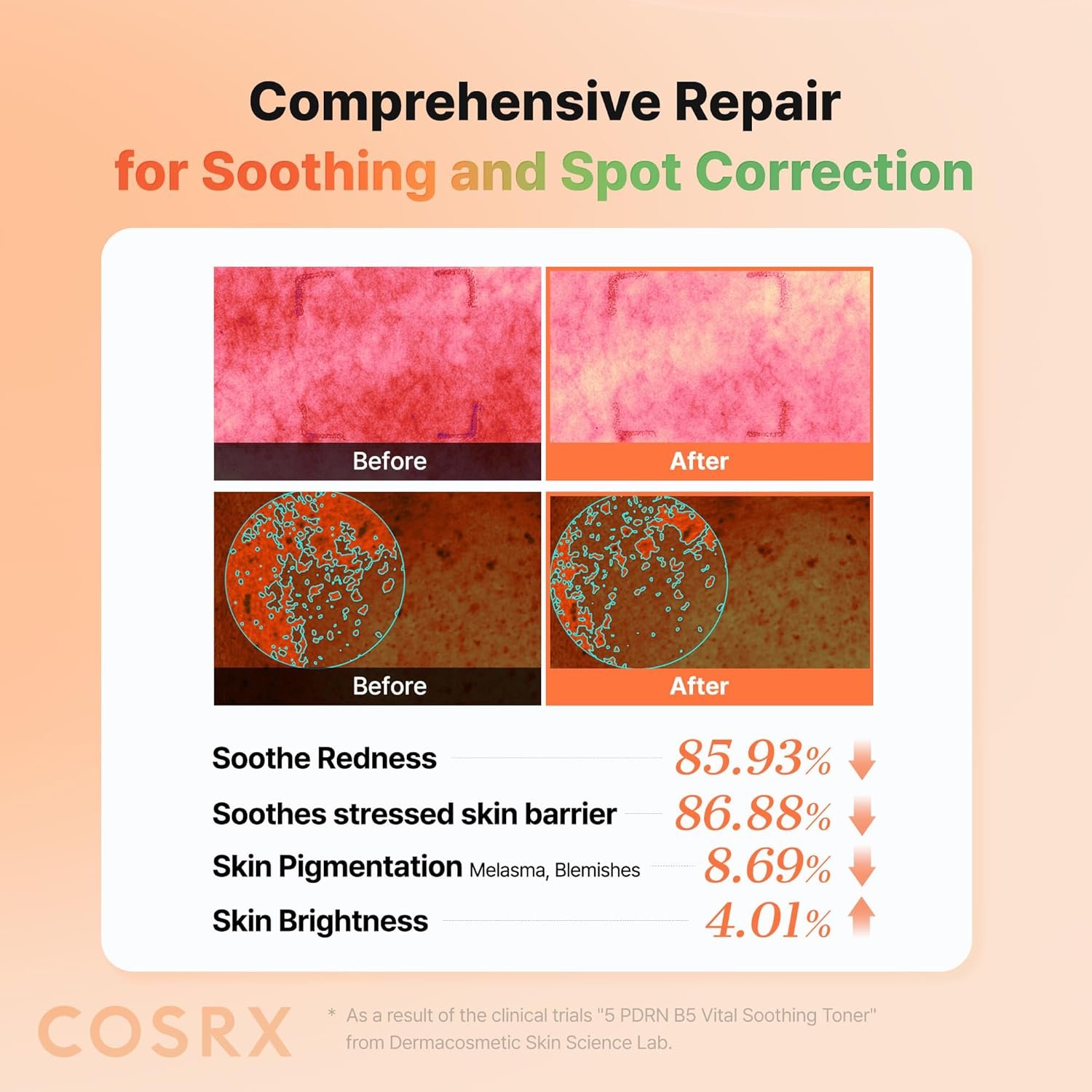 Cosrx 5 PDRN Collagen Intense Vitalizing Serum 100Ml - Image 5