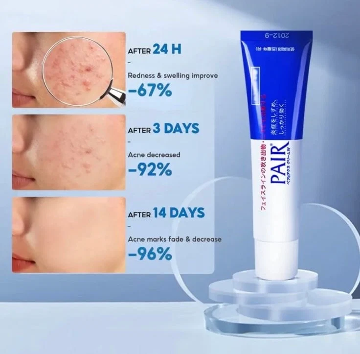 Lion Pair Acne Cream 14g - Image 3