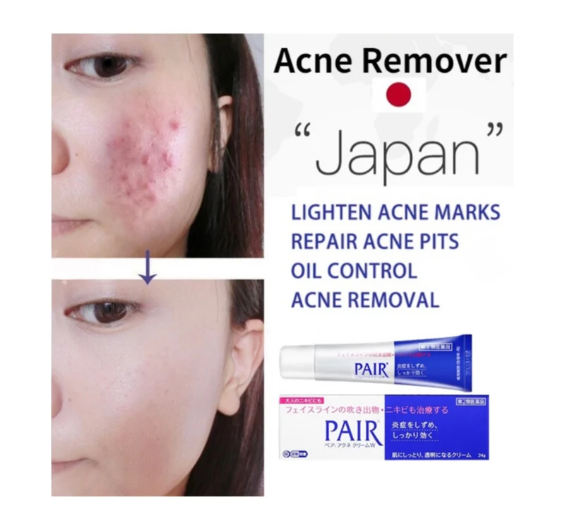 Lion Pair Acne Cream 14g - Image 4
