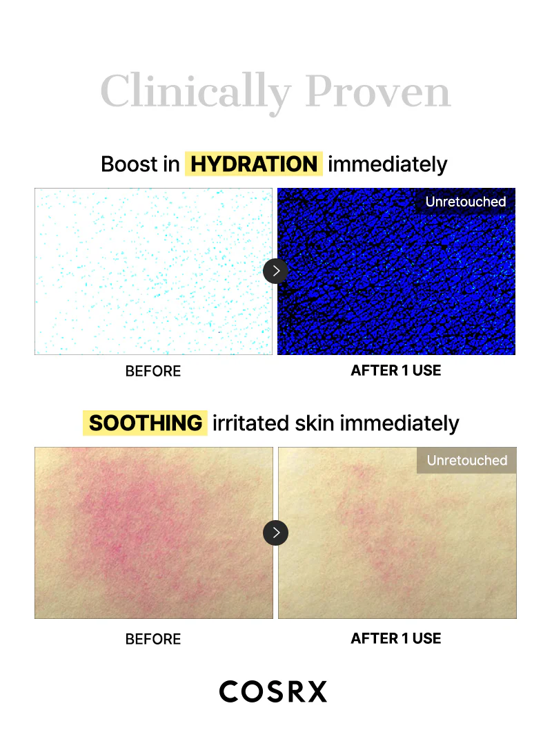 Cosrx Advanced Snail Mucin Glass Glow Hydrogel Mask - Image 4