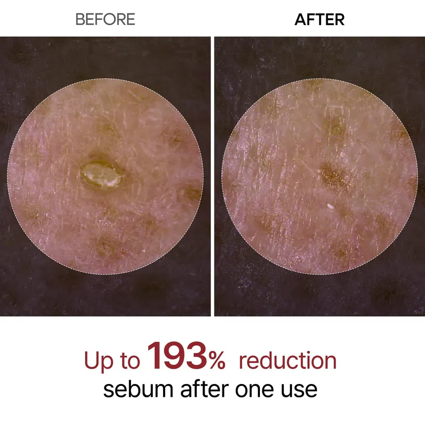 Dr. Melaxin Peel Shot Exfoliating Black Rice Ampoule 80Ml - Image 3