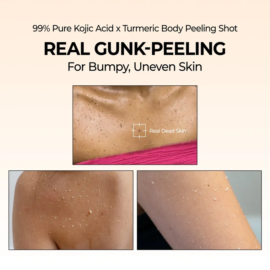 Dr. Melaxin Peel Shot Exfoliating Kojic Acid Turmeric Spray 200Ml - Image 2