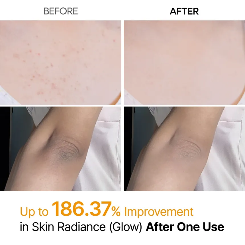 Dr. Melaxin Peel Shot Exfoliating Kojic Acid Turmeric Spray 200Ml - Image 3