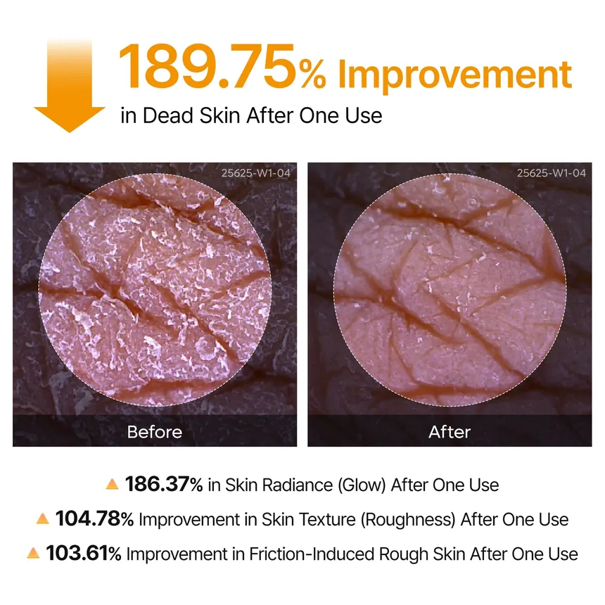 Dr. Melaxin Peel Shot Exfoliating Kojic Acid Turmeric Spray 200Ml - Image 6