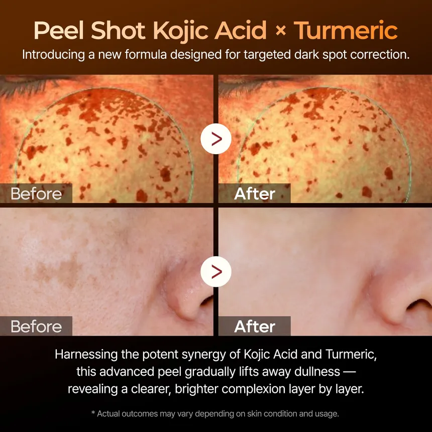 Dr. Melaxin Peel Shot Exfoliating Kojic Acid Turmeric Serum 80Ml - Image 3