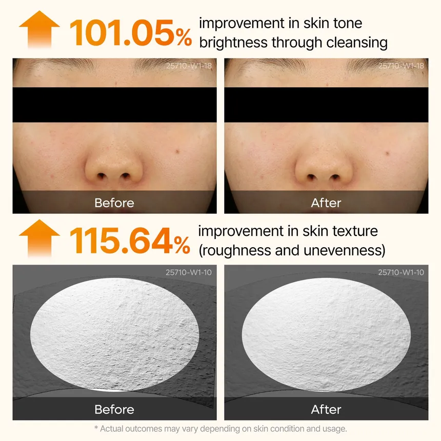 Dr. Melaxin Peel Shot Exfoliating Kojic Acid Turmeric Serum 80Ml - Image 7