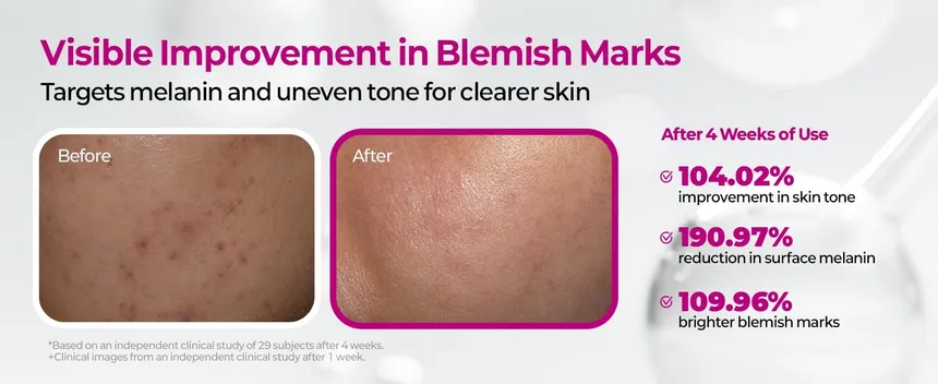 Dr.Melaxin Cemenrete Picotonic Shot Pigmentation Ampoule 30Ml - Image 3