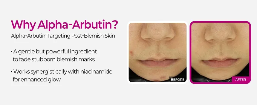 Dr.Melaxin Cemenrete Picotonic Shot Pigmentation Ampoule 30Ml - Image 5