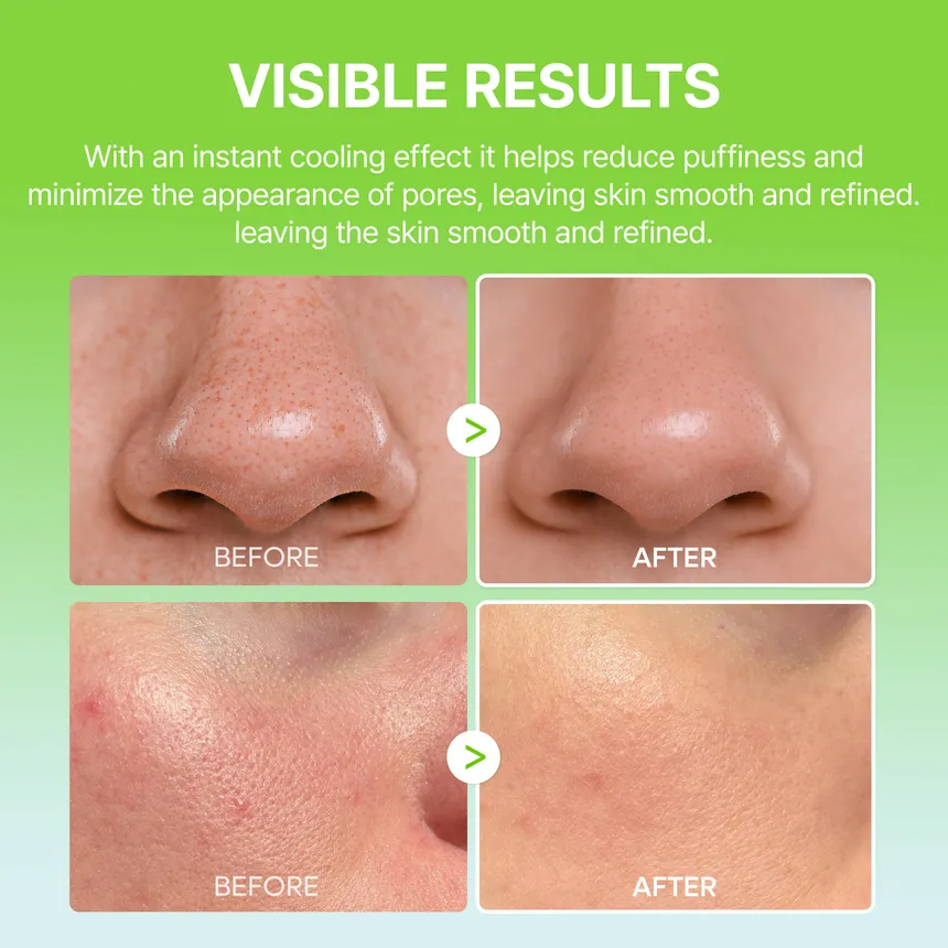 Dr.Melaxin Cactox Pore Relief Multi Balm 25g - Image 5